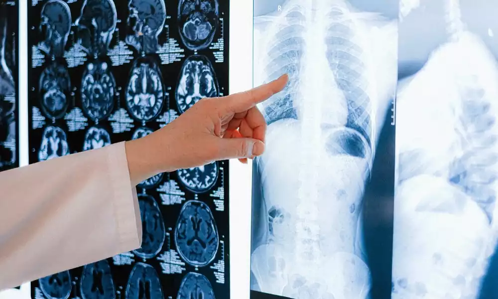 lung diseases